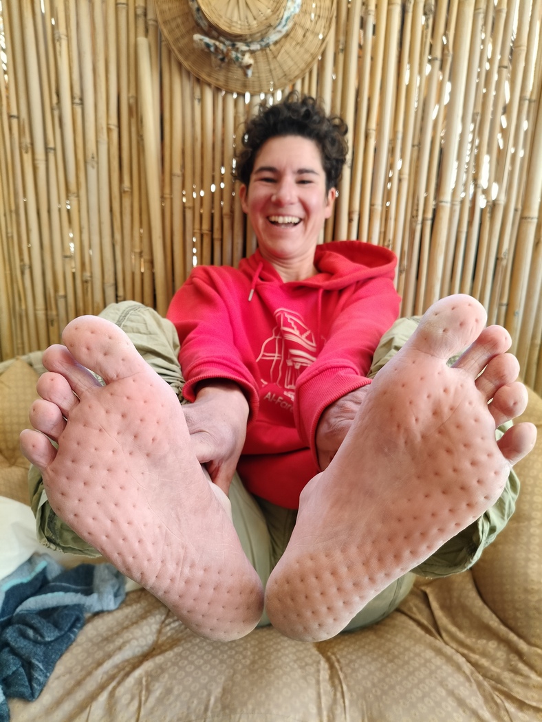 Julias perforierte Füße